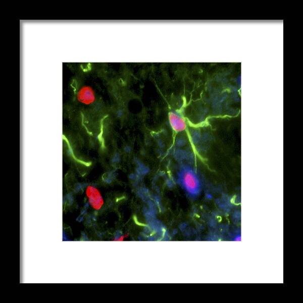 Glial Stem Cell Framed Print featuring the photograph Nerve Cell Trauma Response by Riccardo Cassiani-ingoni