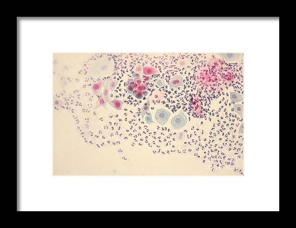 Cytology Smear Framed Print featuring the photograph Normal Stellate Cells by Science Source
