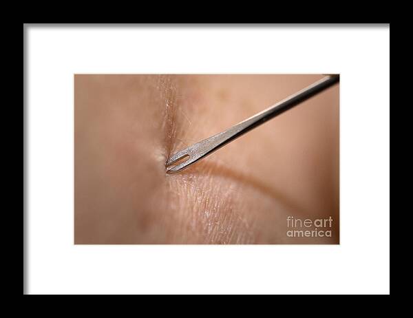Science Framed Print featuring the photograph Smallpox Vaccination, Bifurcated Needle by Science Source