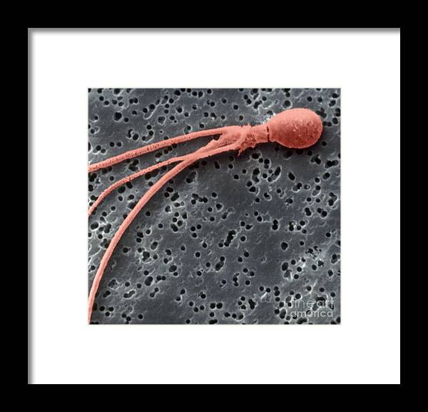 Sperm Framed Print featuring the photograph Abnormal Sperm #1 by Scimat