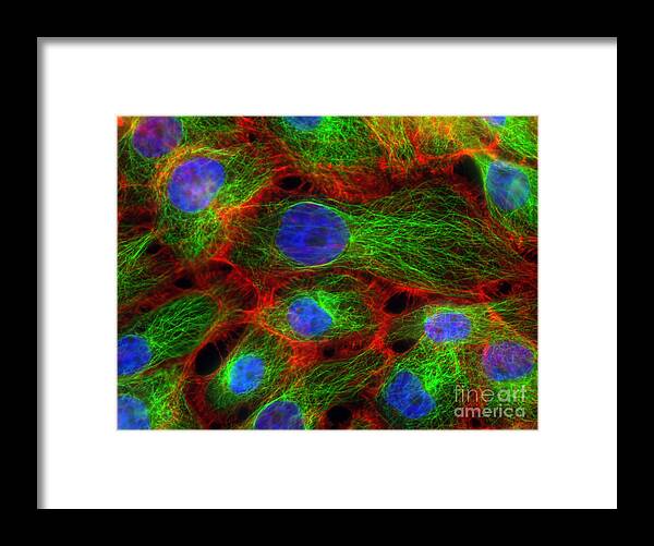 Science Framed Print featuring the photograph Breast Cancer Cells, Fm #6 by Science Source