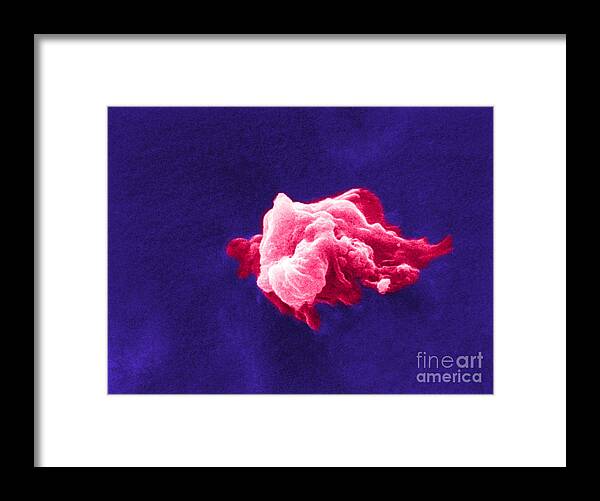 Scanning Electron Micrograph Framed Print featuring the photograph Cancer Cell Death, Sem 6 Of 6 #1 by Science Source