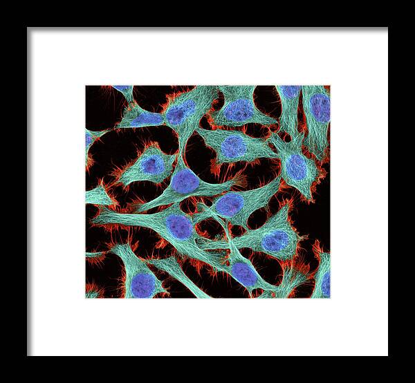 Nucleus Framed Print featuring the photograph Hela Cells, Light Micrograph #1 by Thomas Deerinck, Ncmir