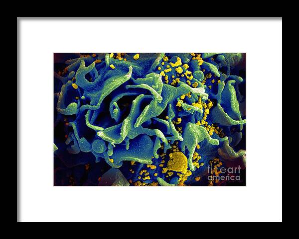 Microbiology Framed Print featuring the photograph Hiv-infected T Cell, Sem by Science Source