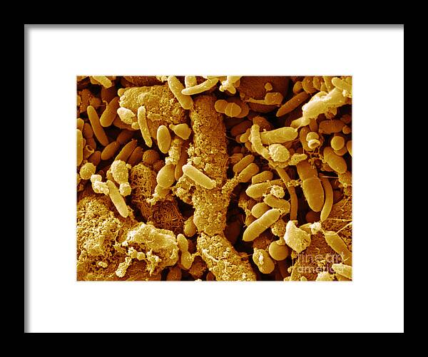 Feces Framed Print featuring the photograph Human Feces Containing Bacteria #1 by Scimat