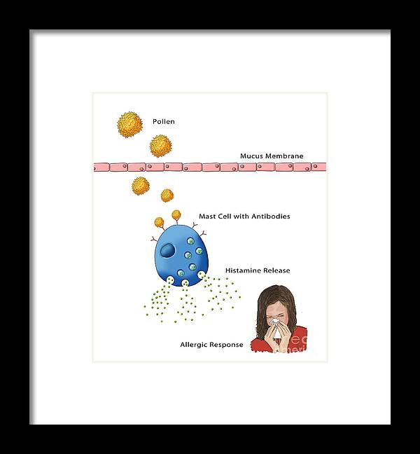 Medical Framed Print featuring the photograph Allergic Response, Illustration by Monica Schroeder