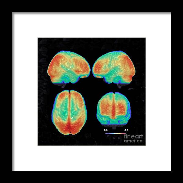 Science Framed Print featuring the photograph Bipolar Brain, 3d Mri Scan by Science Source