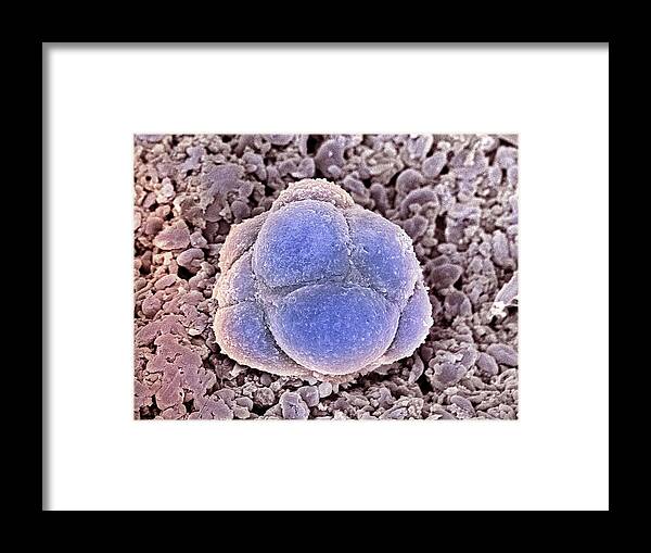 Human Embryonic Stem Cell Framed Print featuring the photograph Stem Cells, Sem by Steve Gschmeissner
