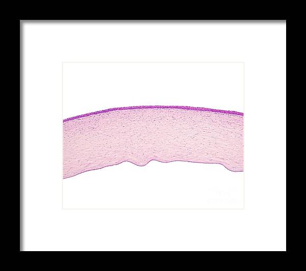 Bowman Layer Framed Print featuring the photograph Cornea Layers by Jose Calvo / Science Photo Library