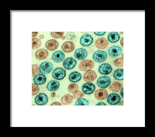 Abnormal Framed Print featuring the photograph Hiv-1, Human Immunodeficiency Virus, Tem #1 by Science Source