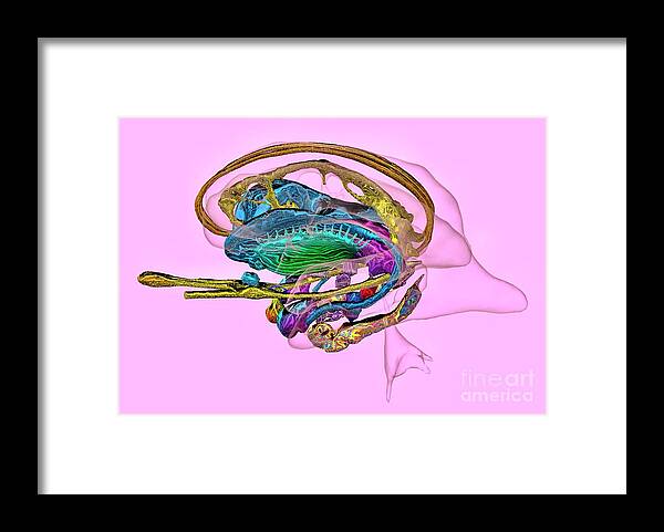 3d Framed Print featuring the photograph Limbic System In Alzheimer's Disease #1 by K H Fung/science Photo Library