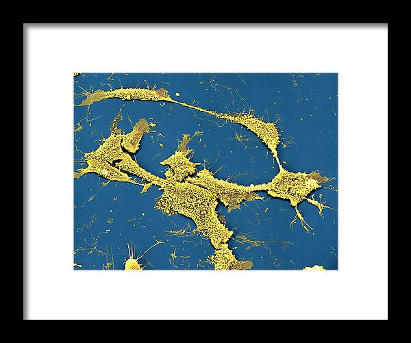 Cancer Framed Print featuring the photograph Neuroblastoma Cells #1 by Meckes/ottawa