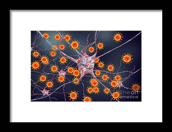 Artwork Framed Print featuring the photograph Viral Encephalitis #11 by Kateryna Kon/science Photo Library