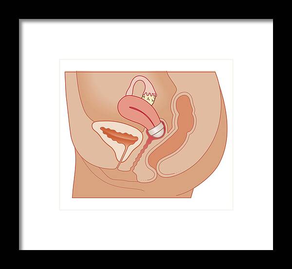 Cervix Framed Print featuring the digital art Cross Section Biomedical Illustration #14 by Dorling Kindersley