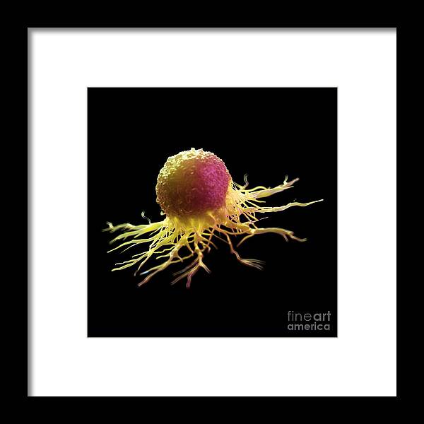 Cancer Framed Print featuring the photograph Cancer Cell #18 by Sebastian Kaulitzki/science Photo Library