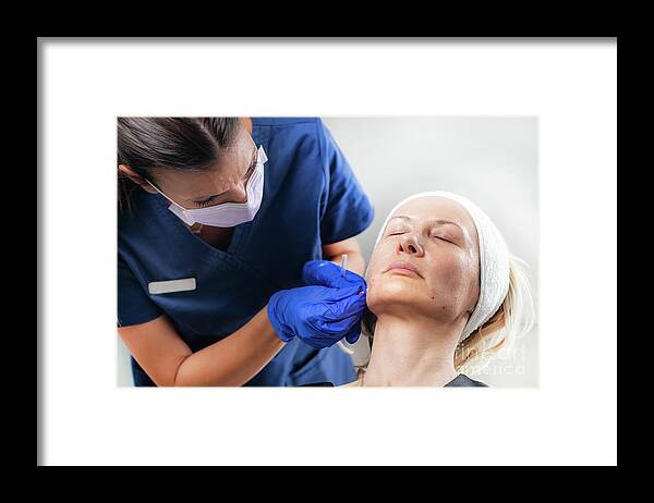 Facelift Framed Print featuring the photograph Mesotherapy Thread Face Lift Procedure #18 by Microgen Images/science Photo Library