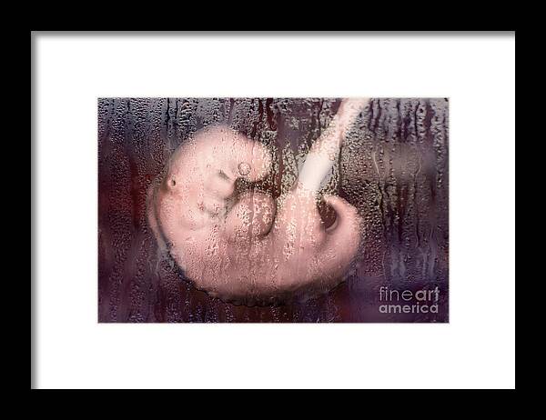 3d Framed Print featuring the photograph Abortion #2 by Kateryna Kon/science Photo Library