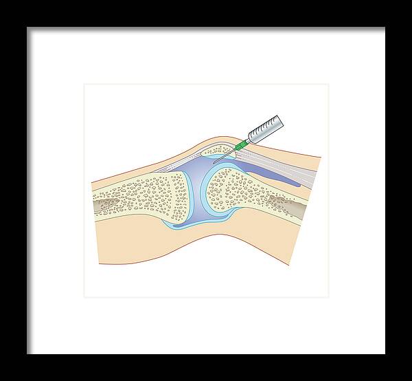 Problems Framed Print featuring the digital art Cross Section Biomedical Illustration #2 by Dorling Kindersley