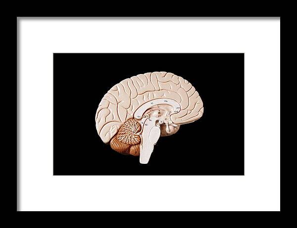 Black Background Framed Print featuring the photograph Human Brain by Richard Newstead