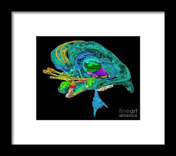 3d Framed Print featuring the photograph Limbic System In Alzheimer's Disease #2 by K H Fung/science Photo Library