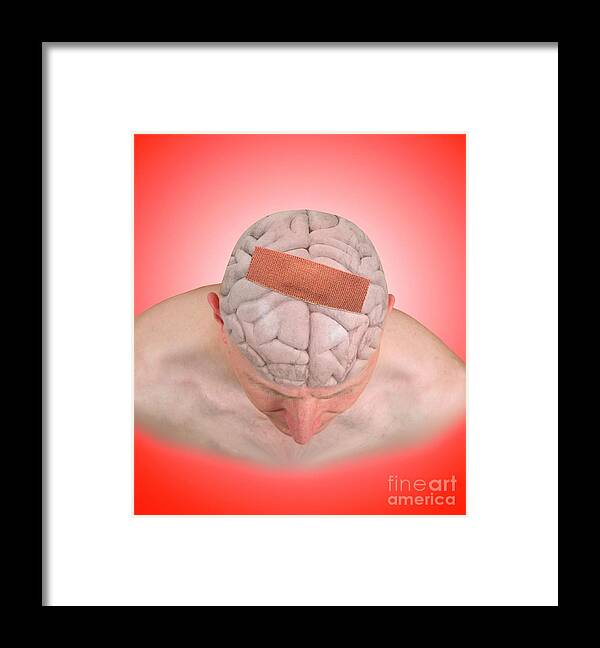 Biological Framed Print featuring the photograph Brain Damage #3 by Victor De Schwanberg/science Photo Library
