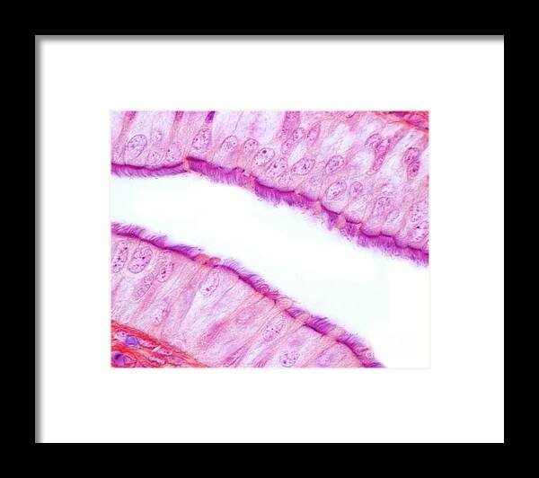 Cell Framed Print featuring the photograph Fallopian Tube Ciliated Epithelium #3 by Jose Calvo/science Photo Library