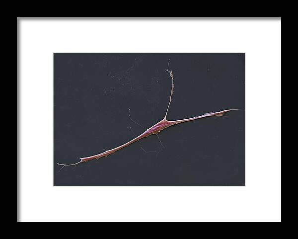 Cancer Framed Print featuring the photograph Muscle Rhabdomyosarcoma Cells Rms, Sem #5 by Meckes/ottawa