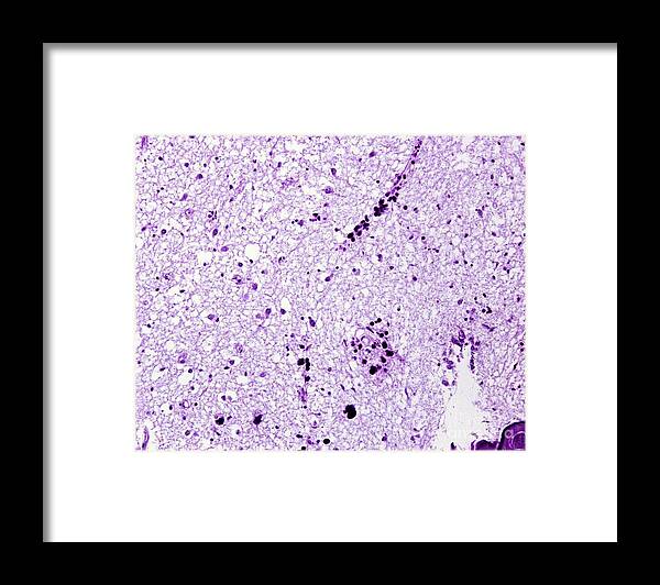 Calcification Framed Print featuring the photograph Calcifications In Habenular Commissure by Jose Calvo / Science Photo Library