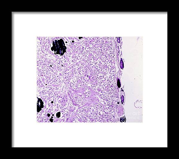 Calcification Framed Print featuring the photograph Calcium Concretions In Human Pineal Gland by Jose Calvo / Science Photo Library