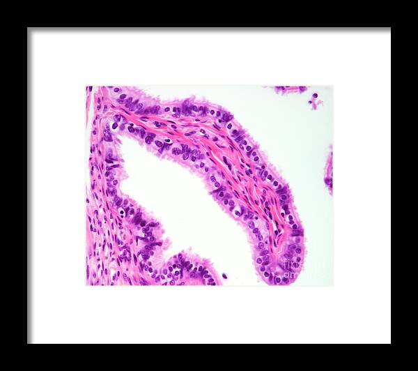 Cell Framed Print featuring the photograph Fallopian Tube Mucosa by Jose Calvo/science Photo Library