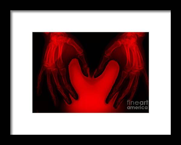 Hand Framed Print featuring the photograph Hands by Rajaaisya/science Photo Library