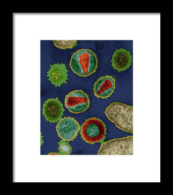 Aids Framed Print featuring the photograph Human Immunodeficiency Virus Hiv by Oliver Meckes EYE OF SCIENCE