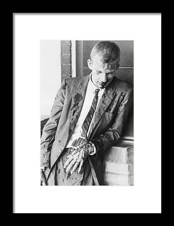Young Men Framed Print featuring the photograph Injured Freedom Rider James Zwerg by Bettmann