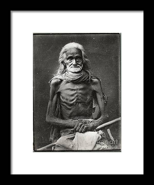 Mature Adult Framed Print featuring the photograph Portrait Of Emaciated Man by Bettmann