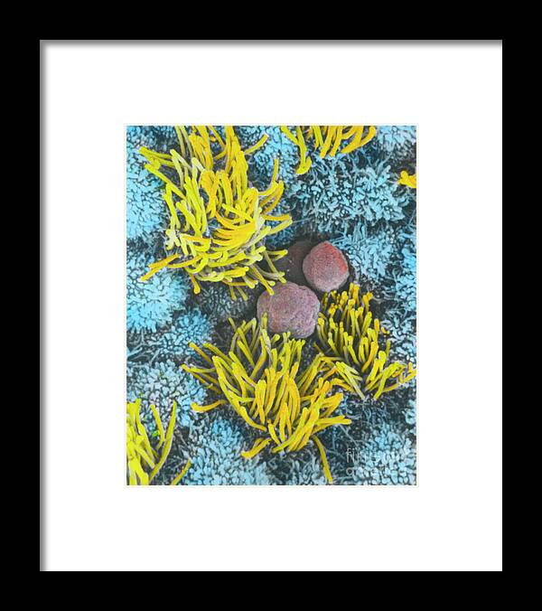Anatomy Framed Print featuring the photograph Sem Of Uterine Lining by Professors P.m. Motta & S. Makabe/science Photo Library