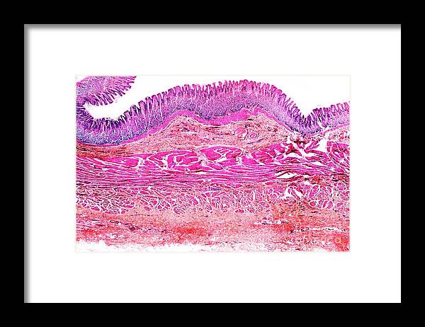 Stomach Framed Print featuring the photograph Stomach Wall by Dr Keith Wheeler/science Photo Library