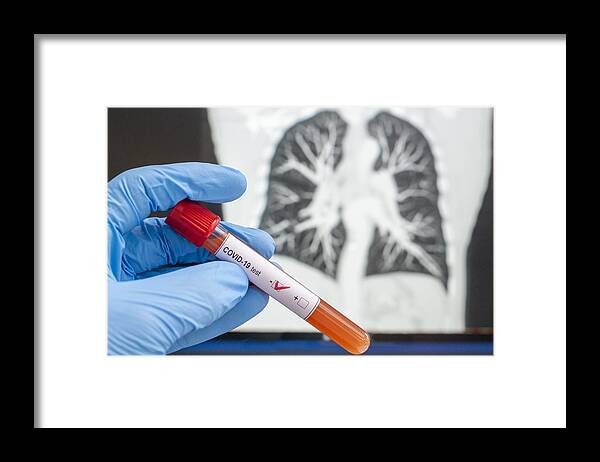 Cold And Flu Framed Print featuring the photograph Coronavirus diagnosed x-ray cat tomography, CT scan, negative blood test for Coronavirus by Paul Biris