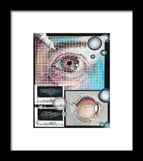 Eye Framed Print featuring the painting Macular Hole Repair by Merana Cadorette