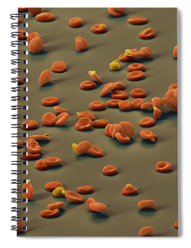 Malaria Parasite Spiral Notebook featuring the photograph Malarial Parasites #1 by Eye of Science