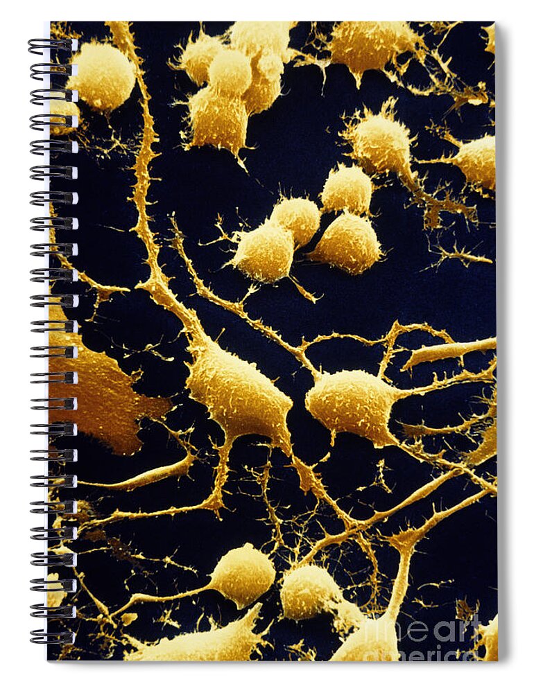 Axon Spiral Notebook featuring the photograph Nerve Cells #1 by David M. Phillips