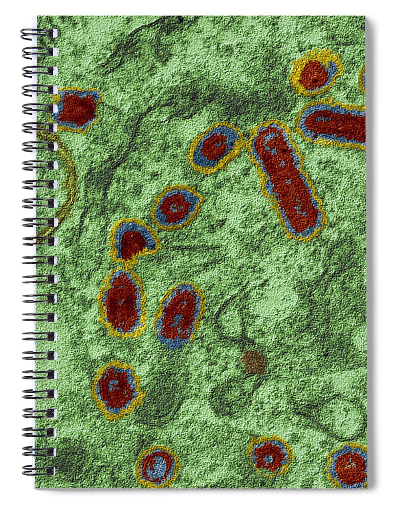Rabies Spiral Notebook featuring the photograph Rabies Infected Cell #1 by Eye of Science