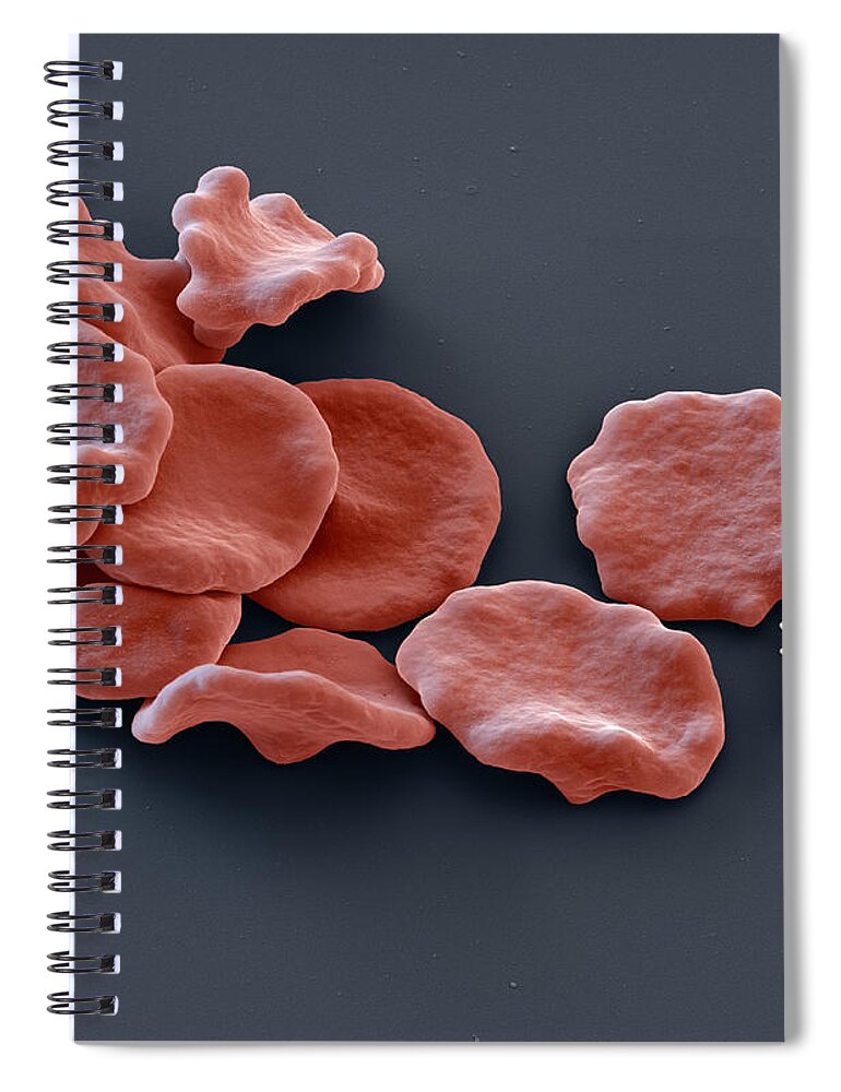 Blood Spiral Notebook featuring the photograph Red Blood Cells And Lymphocyte, Sem #1 by Eye of Science