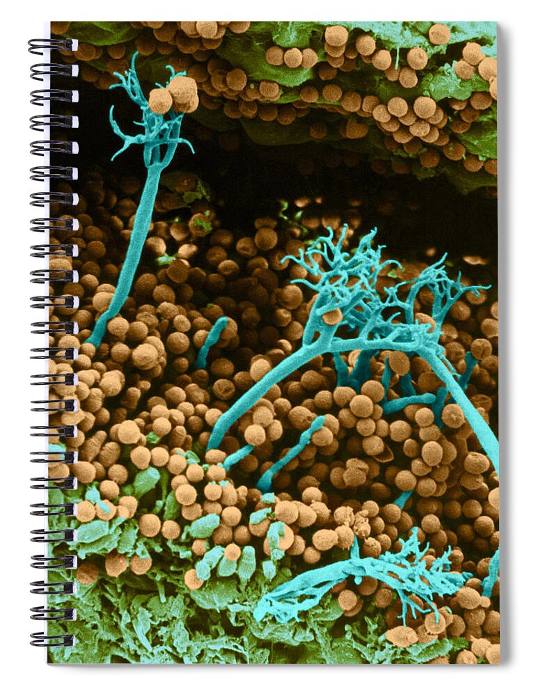Science Spiral Notebook featuring the photograph Surface Of Leaf With Fungal Infections #1 by Biophoto Associates