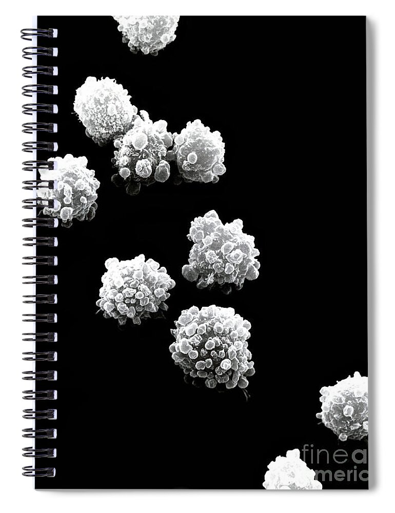 Lymphocyte Spiral Notebook featuring the photograph Lymphocytes Undergoing Apoptosis, Sem #10 by David M. Phillips