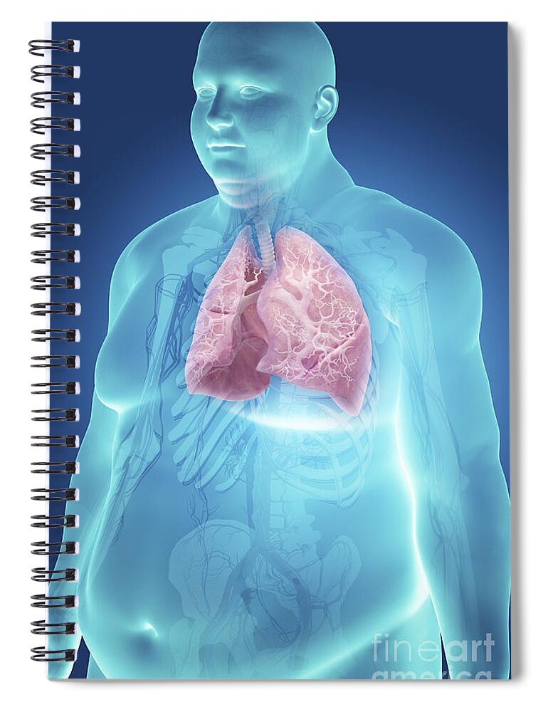 Thorax Spiral Notebook featuring the photograph Obesity #12 by Science Picture Co