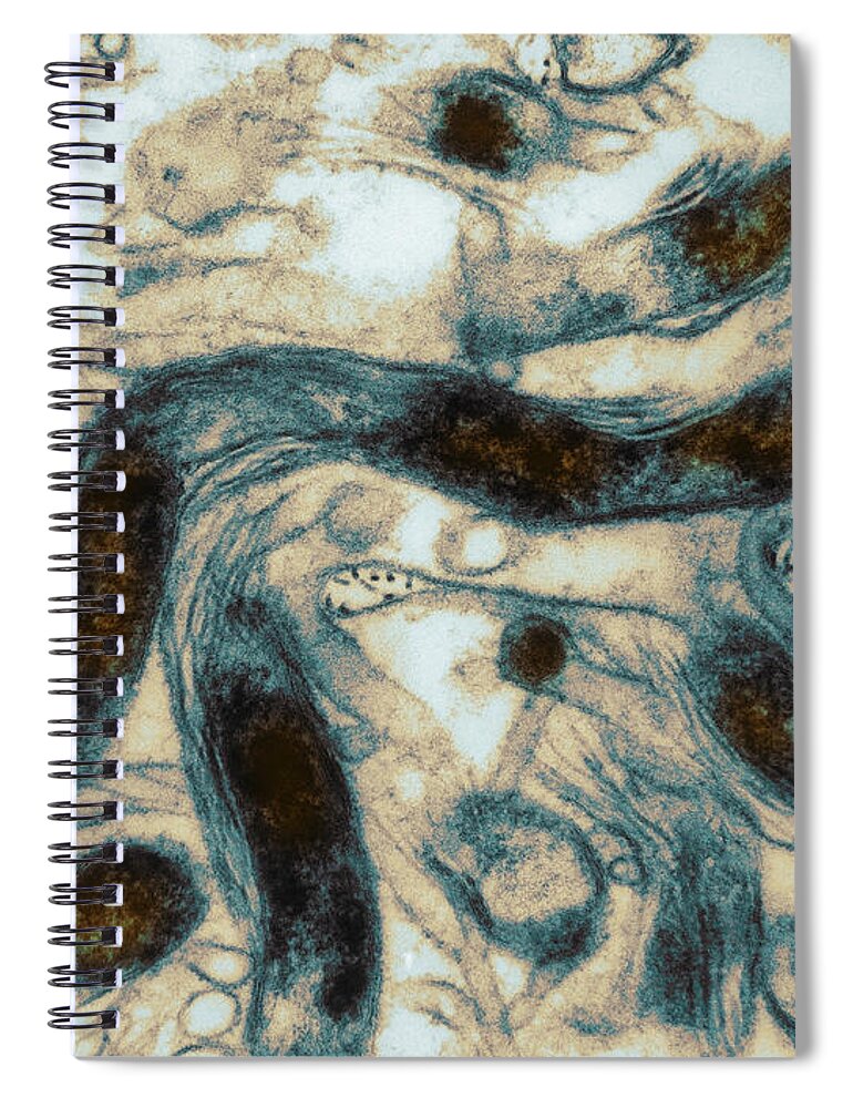 Science Spiral Notebook featuring the photograph Borrelia Burgdorferi Lyme Disease Tem #3 by David M Phillips