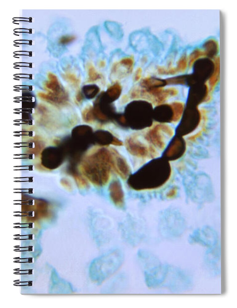 Science Spiral Notebook featuring the photograph Candida Albicans, Fungal Infection, Lm #2 by Science Source