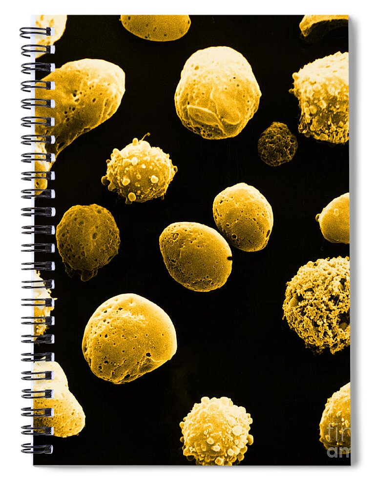 White Blood Cell Spiral Notebook featuring the photograph Lymphocytes Undergoing Apoptosis, Sem #2 by David M. Phillips