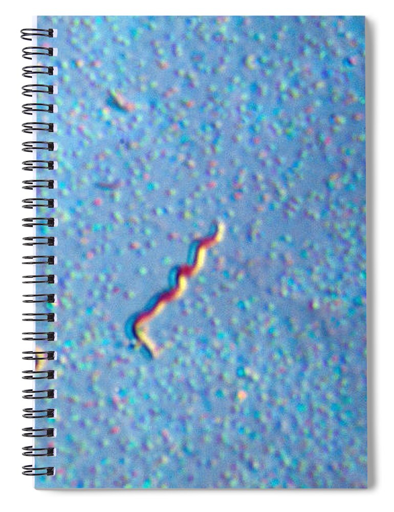 Aerobic Bacteria Spiral Notebook featuring the photograph Treponema Pallidum, Lm #2 by Michael Abbey