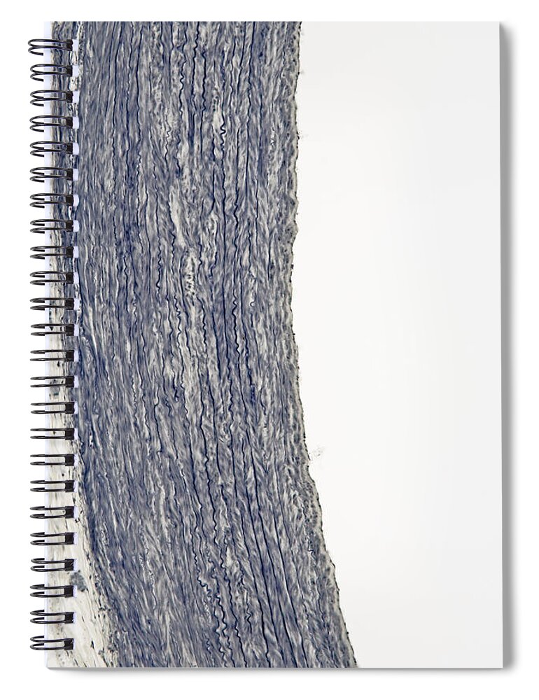 Light Micrograph Spiral Notebook featuring the photograph Cross-section Of Aorta Wall, Elastic #3 by Science Stock Photography